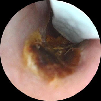 <h2>Cosa dicono di BeClean View?</h2>