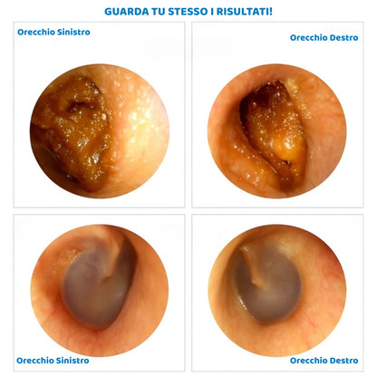 BeClean View - Per una pulizia auricolare consapevole