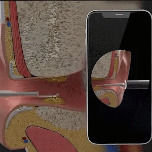 BeClean View - Per una pulizia auricolare consapevole